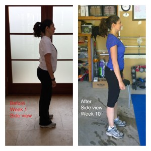 FarrahSidebeforeAfter